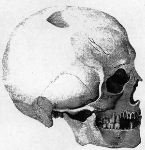 Bene vitéz koponyájának rajza az 1834-ben megjelent cikkben